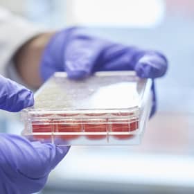 research into heart and circulatory diseases