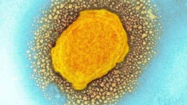 How monkeypox looks under a scientific microscope