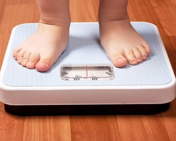 Tackling childhood obesity
