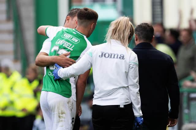 Hibs midfielder Josh Campbell picked up an injury in the Edinburgh derby.