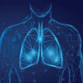 PneumoWave says its remote patient-monitoring technology can assist early detection of potentially fatal conditions including chronic obstructive pulmonary disease, opioid-induced respiratory depression, and paediatric respiratory monitoring. Picture: contributed.