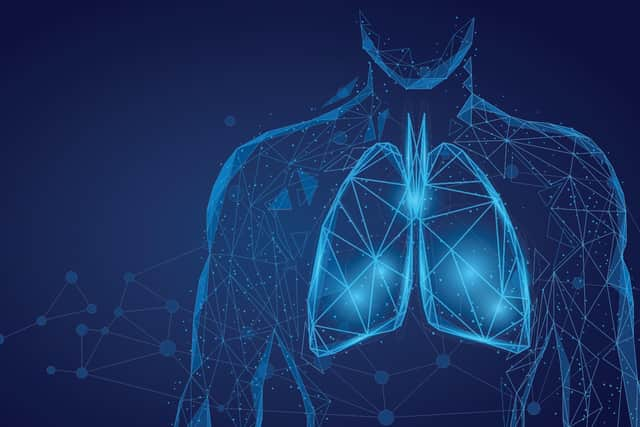 PneumoWave says its remote patient-monitoring technology can assist early detection of potentially fatal conditions including chronic obstructive pulmonary disease, opioid-induced respiratory depression, and paediatric respiratory monitoring. Picture: contributed.