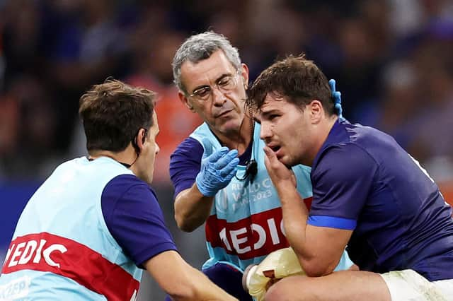 Antoine Dupont has damaged his cheekbone - with France unsure how long he will be out for.