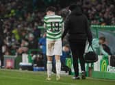 Celtic's Mikey Johnston suffered an injury  during a Scottish Cup match with Raith Rovers. (Photo by Craig Foy / SNS Group)