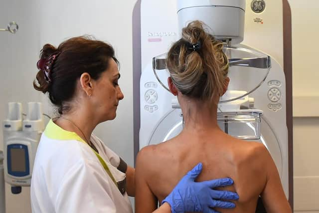 Eligible women will be invited for their first breast screening mammogram before their 53rd birthday. Photo: ANNE-CHRISTINE POUJOULAT/AFP via Getty Images