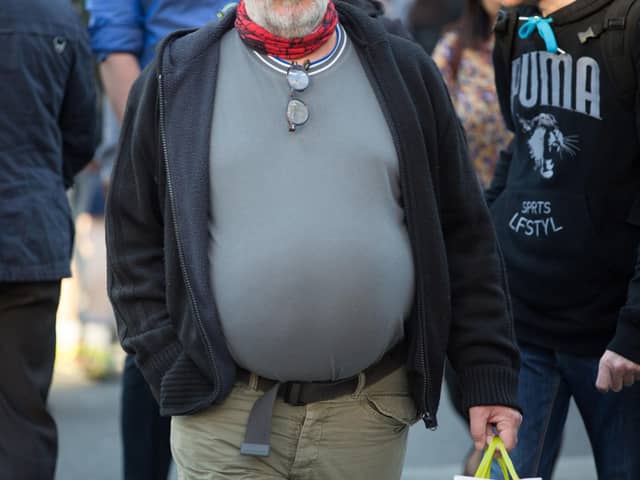 Obesity and alcohol are driving up bowel cancer cases among young people in the UK, researchers have warned. Photo: Daniel Leal-Olivas/PA Wire