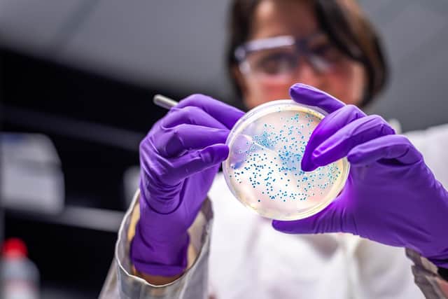 The latest data from the UK’s Health Security Agency (UKHSA) shows that as of June 11, there have been 211 confirmed cases of e. coli.