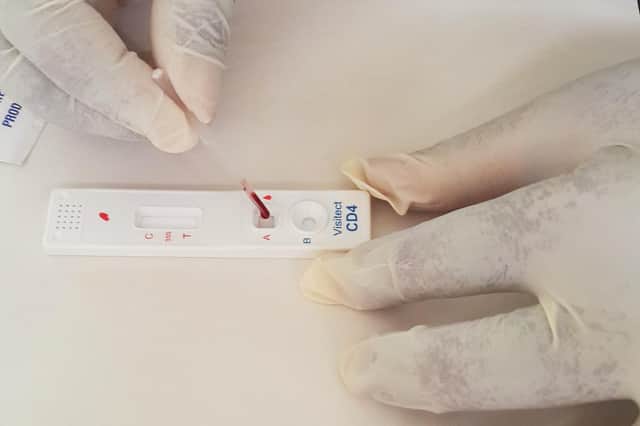 Omega Diagnostics has pointed to substantial growth opportunities in the areas of food intolerance, CD4 testing for the management of people living with HIV, and Covid-19 antibody and antigen testing.