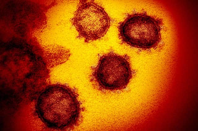 The Novel Coronavirus Sars-CoV-2, which causes Covid-19. Picture: AP.