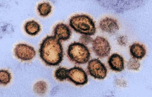 Whittall claimed she had coronavirus. Picture: by HANDOUT/National Institutes of Health/AFP via Getty Images)