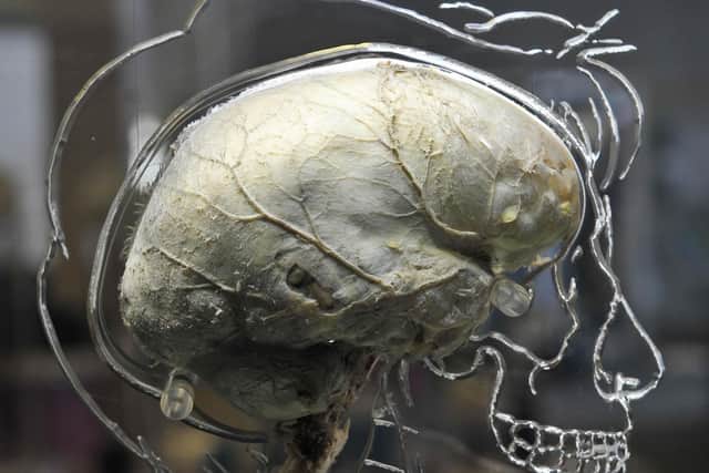 A human brain suspended in liquid with a to-scale skeleton. Picture: Ben Birchall/PA Wire