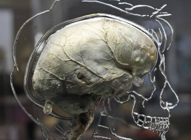 A human brain suspended in liquid with a to-scale skeleton. Picture: Ben Birchall/PA Wire