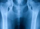 Is your beloved pup at risk of developing hip dysplasia?
