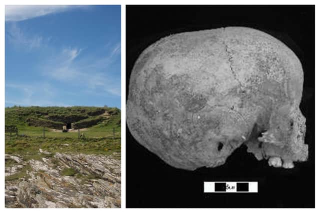 Evidence of head binding on Orkney? A child's skull found in the Tomb of The Eagles at Isbister, Orkney which shows a hollow around half way along. It has been suggested this could have been due to deliberate manipulation, which was carried out in some cultures to project status and identity. PIC: Dr Dave Lawrence/Tomb of The Eages.