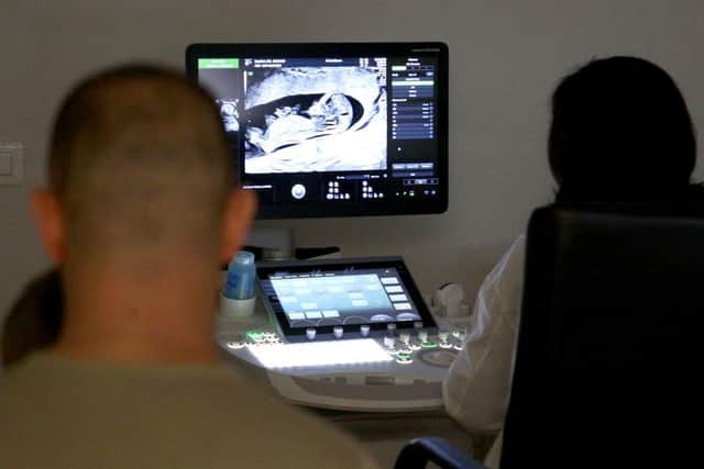 A gynaecologist performs a sonogram on a pregnant woman, pictured with her husband. Picture: Adnan Beci/AFP via Getty Images
