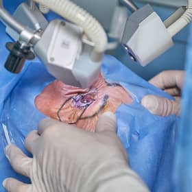 Waiting lists for cataract surgery are soaring.