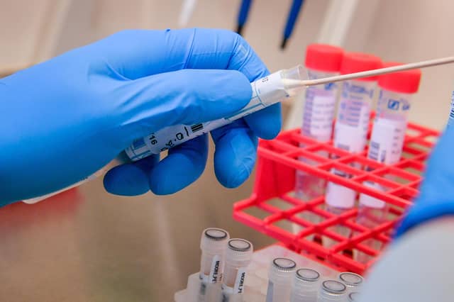 England's rate of Covid-19 infection is higher than Scotland's.