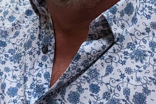 Ian Keir, 63, from Carnoustie, underwent the procedure for the first time in Scotland. Photo: University of Dendee/PA Wire