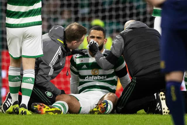 Cameron Carter-Vickers receives treatement for a bloody nose during the 2-0 win over Kilmarnock. (Photo by Craig Williamson / SNS Group)