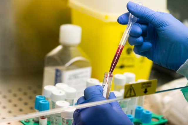 A medical worker handles blood samples as part of tests for Covid-19, which was not invented in a laboratory and for which there is no 'secret cure' (Picture: Tiziana Fabi/AFP via Getty Images)