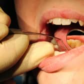 One in 10 dentists in Scotland have stopped carrying out NHS treatments since the onset of the Covid-19 pandemic, it has been revealed.