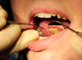 One in 10 dentists in Scotland have stopped carrying out NHS treatments since the onset of the Covid-19 pandemic, it has been revealed.
