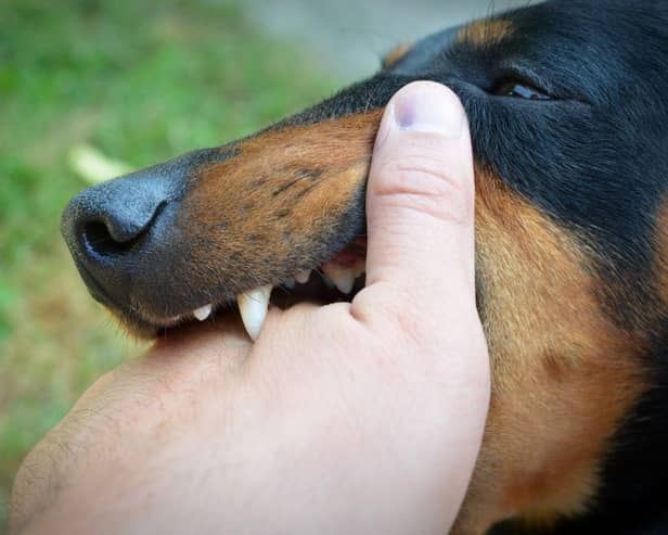 Some dogs are more likley than others to deliver painful bites.