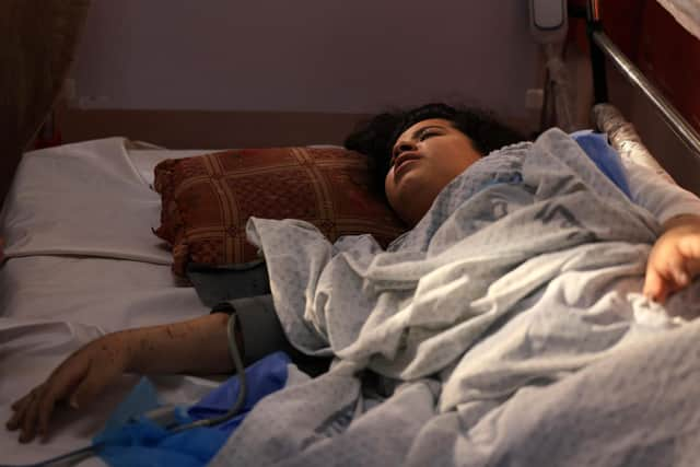 Dunia Abu Mohsen, 12, lost her leg in a bomb blast that killed her family. She was killed when the Nasser hospital in Khan Yunis, southern Gaza Strip, was shelled (Picture: Mahmud Hams/AFP via Getty Images)