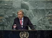 United Nations Secretary General Antonio Guterres  (Photo by Anna Moneymaker/Getty Images)