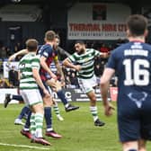 Celtic were awarded a penalty after Ross County captain Alex Iacovitti handled the ball in the box under pressure from Cameron Carter-Vickers