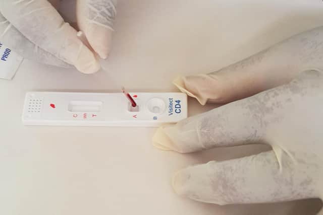 Omega Diagnostics' Visitect CD4 product enables people with HIV to test their immune systems.
