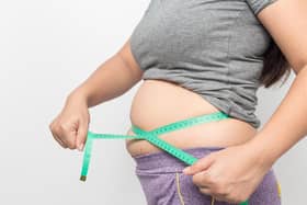 Obesity in the UK affects around one in every four adults