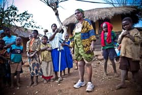 The 500 miles prosthetic and orthotic clinic. Picture:: @paulopatrunophotography