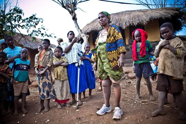 The 500 miles prosthetic and orthotic clinic. Picture:: @paulopatrunophotography