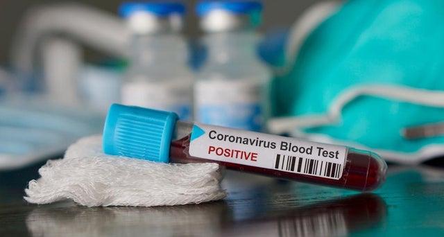 A member of Staff at the New Craigs Hospital in Inverness has tested positive for Covid-19