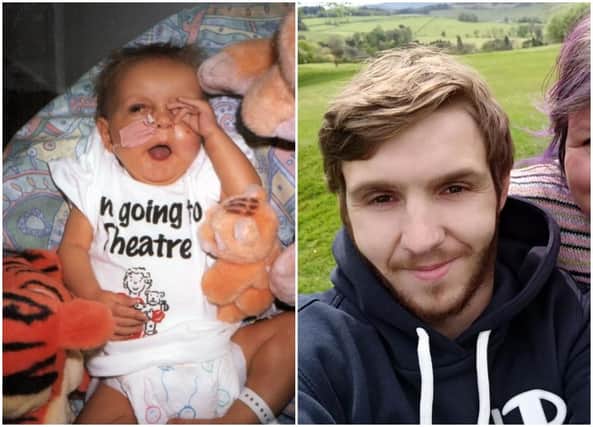 Aaron, now 24, and aged one before he had the transplant.