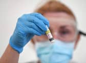 There has been a huge spike in new cases of Covid-19 in Scotland
