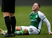 Hibs winger Aiden McGeady suffered a serious hamstring injury against Kilmarnock.