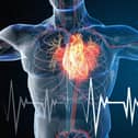 Women are far more likely to die after a heart attack than men, a new study has revealed. Picture: Getty Images