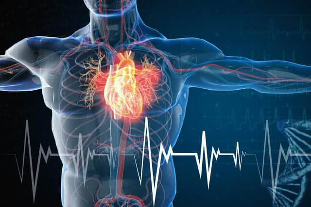 Women are far more likely to die after a heart attack than men, a new study has revealed. Picture: Getty Images