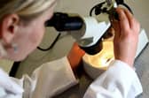 The study analysed data from a randomised set of almost 50,000 individuals who had a blood sample taken between 2006 and 2010.