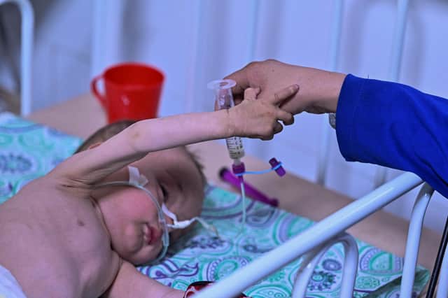 A baby receives treatment for malnutrition at a Doctors Without Borders (MSF) nutrition centre in Herat Afghanistan, last month (Picture: Hector Retamal/AFP via Getty Images)