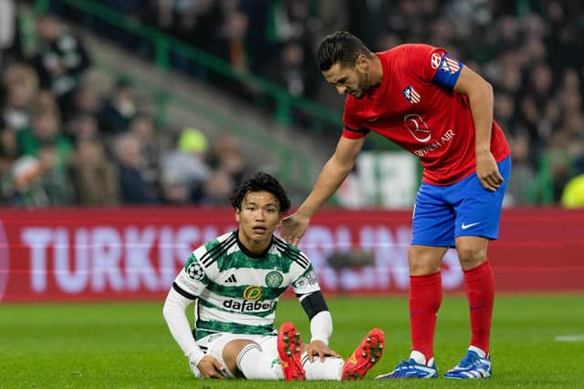 Hatate suffered a hamstring injury while playing in the Champions League against Atletico Madrid.