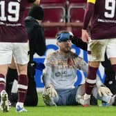 Hearts goalkeeper Zander Clark recieves treatment after being hit by an object from the crowd during the 3-0 win over Hibs. (Photo by Mark Scates / SNS Group)