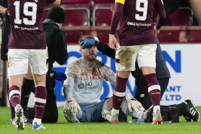 Hearts goalkeeper Zander Clark recieves treatment after being hit by an object from the crowd during the 3-0 win over Hibs. (Photo by Mark Scates / SNS Group)