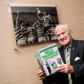 Celtic European Cup winner Bertie Auld has been diagnosed with dementia