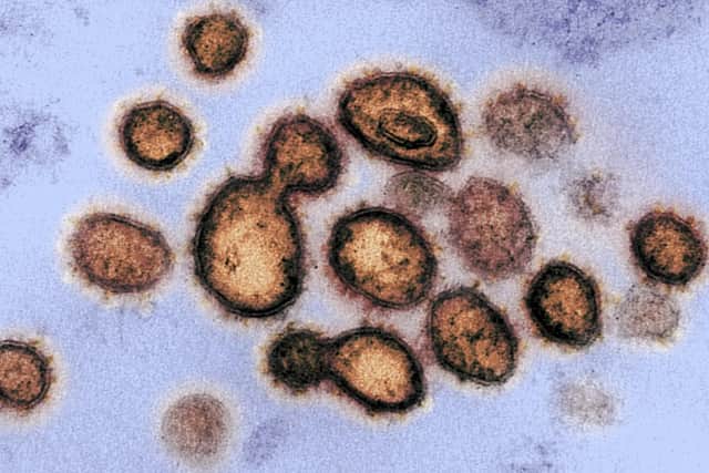 The virus under a microscope. Picture: National Institutes of Health/AFP via Getty Images
