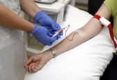 Delayed diagnosis may contribute to poor survival rates for some cancers, says the Less Survivable Cancers Taskforce