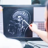 We are increasingly aware of the lifestyle factors that can help us take better care of our brain, but what could the future hold for treatment?