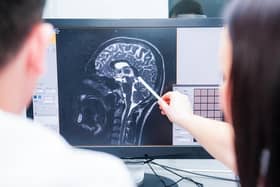 We are increasingly aware of the lifestyle factors that can help us take better care of our brain, but what could the future hold for treatment?